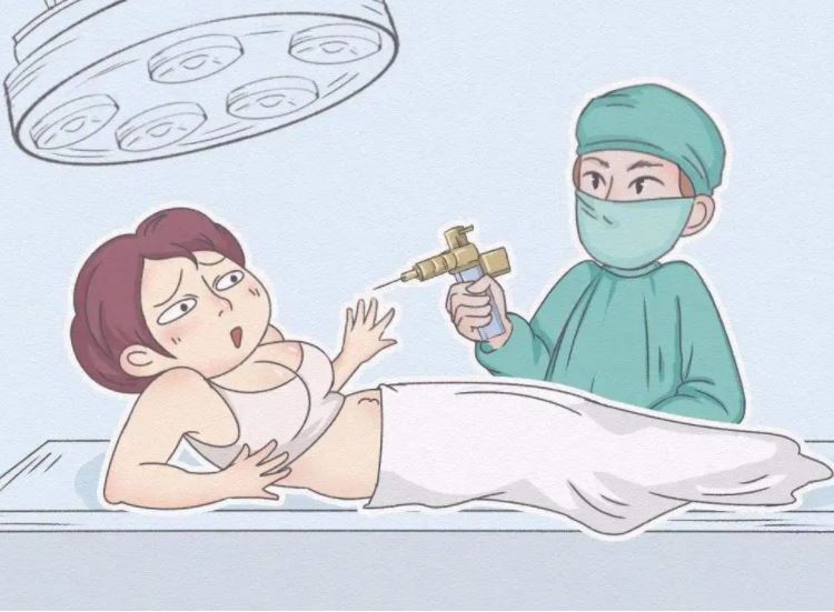 全身抽脂對身體有什么傷害？